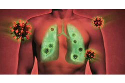 COPD and lungs