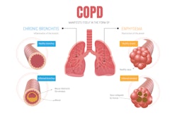 infographic showing COPD