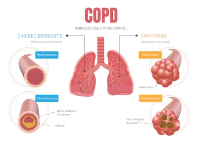 infographic showing COPD