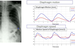 Dynamic digital radiography is an enhanced X-ray technology that enables clinicians to analyze and quantify the dynamic interaction of anatomical structures with physiological changes over time to enhance diagnostic capability and efficacy.