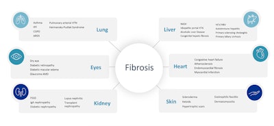 Fibrosis Model