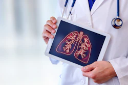 Image of doctor holding a tablet with a graphic display of lungs