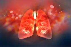 Graphic of human lungs