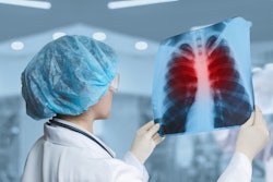 Image of doctor holding up a lung x-ray for inspection