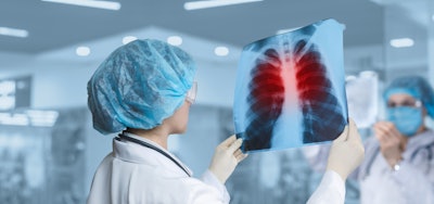 Image of doctor holding up a lung x-ray for inspection