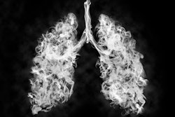 Graphic of smoke in the shape of lungs.
