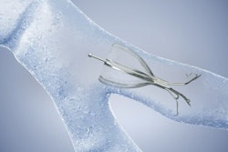 Image of the Spiration Valve System from Olympus
