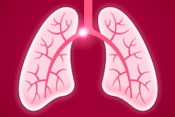 Graphic of lungs with pulmonary embolism