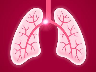 Graphic of lungs with pulmonary embolism