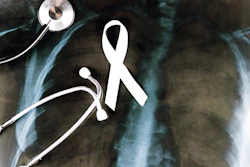 White ribbon as a symbol of lung cancer and stethoscope lying on the lung x-ray.