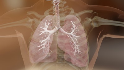 Photo displays x-ray image of damaged, inflammed lung.