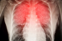 Image of inflammed human lungs.