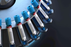 Blood Centrifuge Machine in the laboratory.
