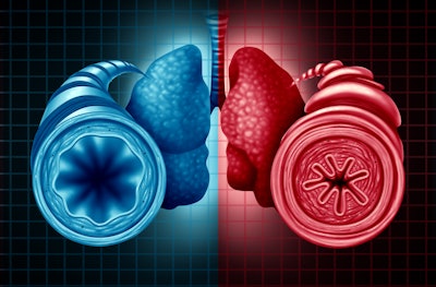 This photo illustrates a diagram of a good lung and an inflamed lung;