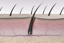 Skin tissues and hair follicle cross-section.