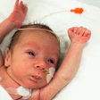 This is a photo of a premature baby in the NICU.
