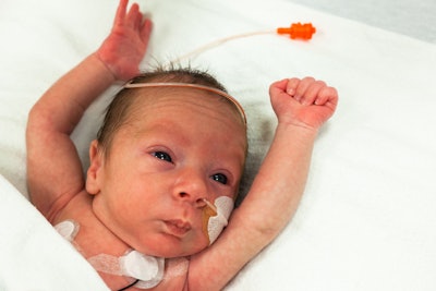 This is a photo of a premature baby in the NICU.