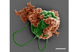 Colored SEM image of a microrobot made of an algae cell (green) covered with drug-filled nanoparticles (orange) coated with red blood cell membranes.