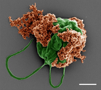 Colored SEM image of a microrobot made of an algae cell (green) covered with drug-filled nanoparticles (orange) coated with red blood cell membranes.