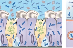 This is an illustration of mucus and cilia in the lungs.