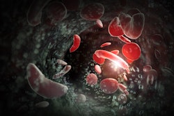 3D illustration of sickle cells