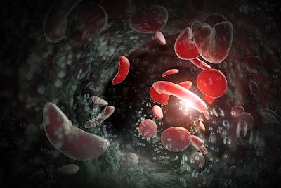 3D illustration of sickle cells