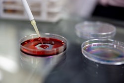 Close-up analyzing blood samples at the laboratory.