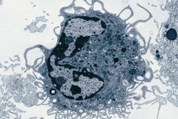 The newly discovered macrophage observed by electron microscopy.