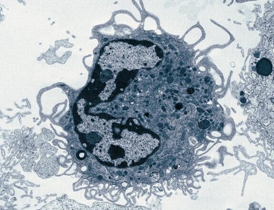 The newly discovered macrophage observed by electron microscopy.