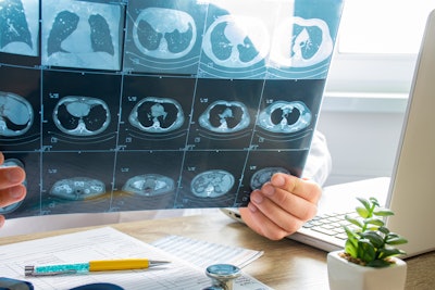 Doctor inspects and examines CT scan of chest, lungs.