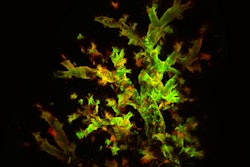 A 3D reconstruction of a mouse lung four days after infection with fluorescent Sendai virus reveals widespread virus presence (red) and active replication (green).