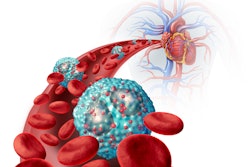 This is an illustration of eosinophils in asthma.