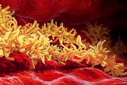 Accumulation of tuberculosis bacteria inside pulmonary tract