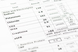 This is a paper medical record of blood lab work.