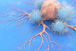 Image of natural killer cells attacking a cancer cell in the lungs.