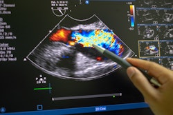 Echocardiography ultrasound machine image