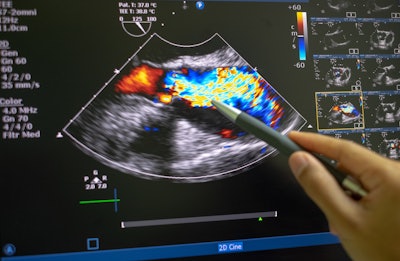 Echocardiography ultrasound machine image