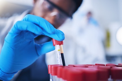 This photo shows a lab tech working with test tubes filled with blood samples.