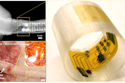 Robotic sensory cilia help monitor airway environment