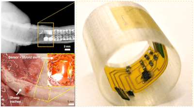 Robotic sensory cilia help monitor airway environment
