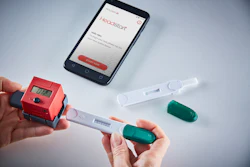 Image of a urine test that uses AI and a smartphone to predict COPD flare ups