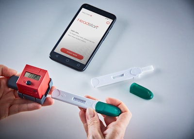 Image of a urine test that uses AI and a smartphone to predict COPD flare ups