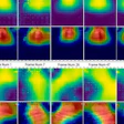 Heatmaps the AI assessed to make lung disease diagnoses.