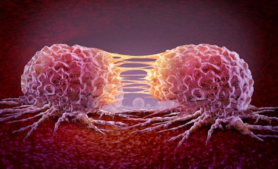 Malignant Cancerous Growth as growing dividing tumor cells and Malignancy disease spreading metastasized on an organ inside the human body as a 3D illustration.