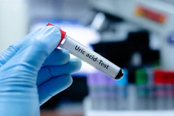 Blood sampling tube for uric acid analysis.