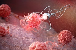 Nanobot seeking and destroying cancer cells or viruses inside human organs.