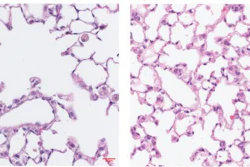 Prolonged exposure to cigarette smoke destroys the air sacs in mouse lungs (left). But this destruction is prevented in mice lacking MAIT cells (right).