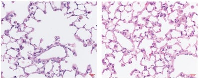 Prolonged exposure to cigarette smoke destroys the air sacs in mouse lungs (left). But this destruction is prevented in mice lacking MAIT cells (right).