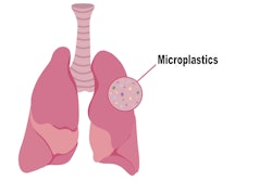 Graphic of a pair of lungs with microplastics in them.