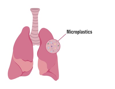 Graphic of a pair of lungs with microplastics in them.